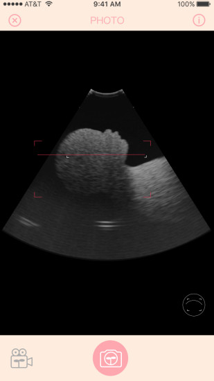 胎儿相机 截图2