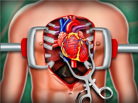 模拟心脏手术 截图1
